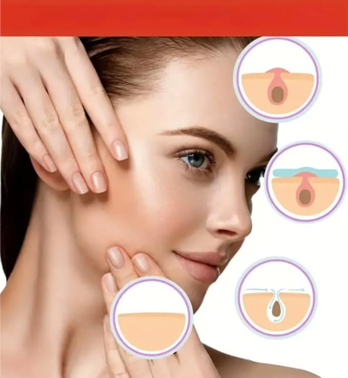 288 Pcs Skin Tag & Acne Pimple Patches