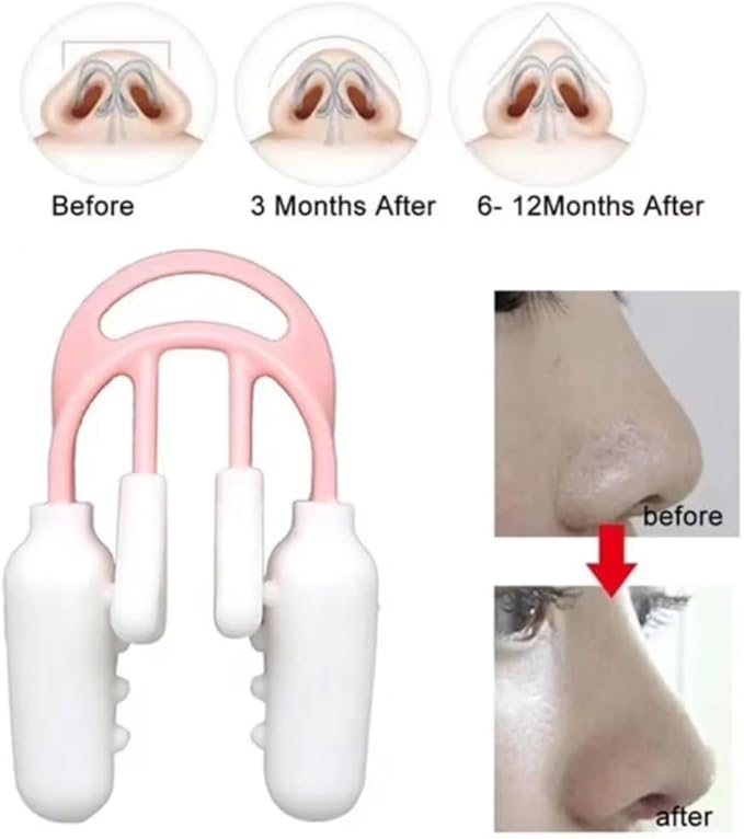 Nose Up Lifting Shaping Shaper Orthotics Clip