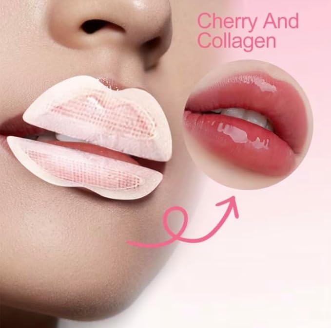Instant Lip Filler Patches with 400 Dissolving Micro-Darts - Lip Plumping Mask