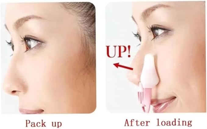 Nose Up Lifting Shaping Shaper Orthotics Clip