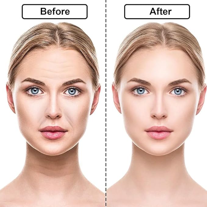 16 Pcs Reusable Silicone Anti-Wrinkle Patches