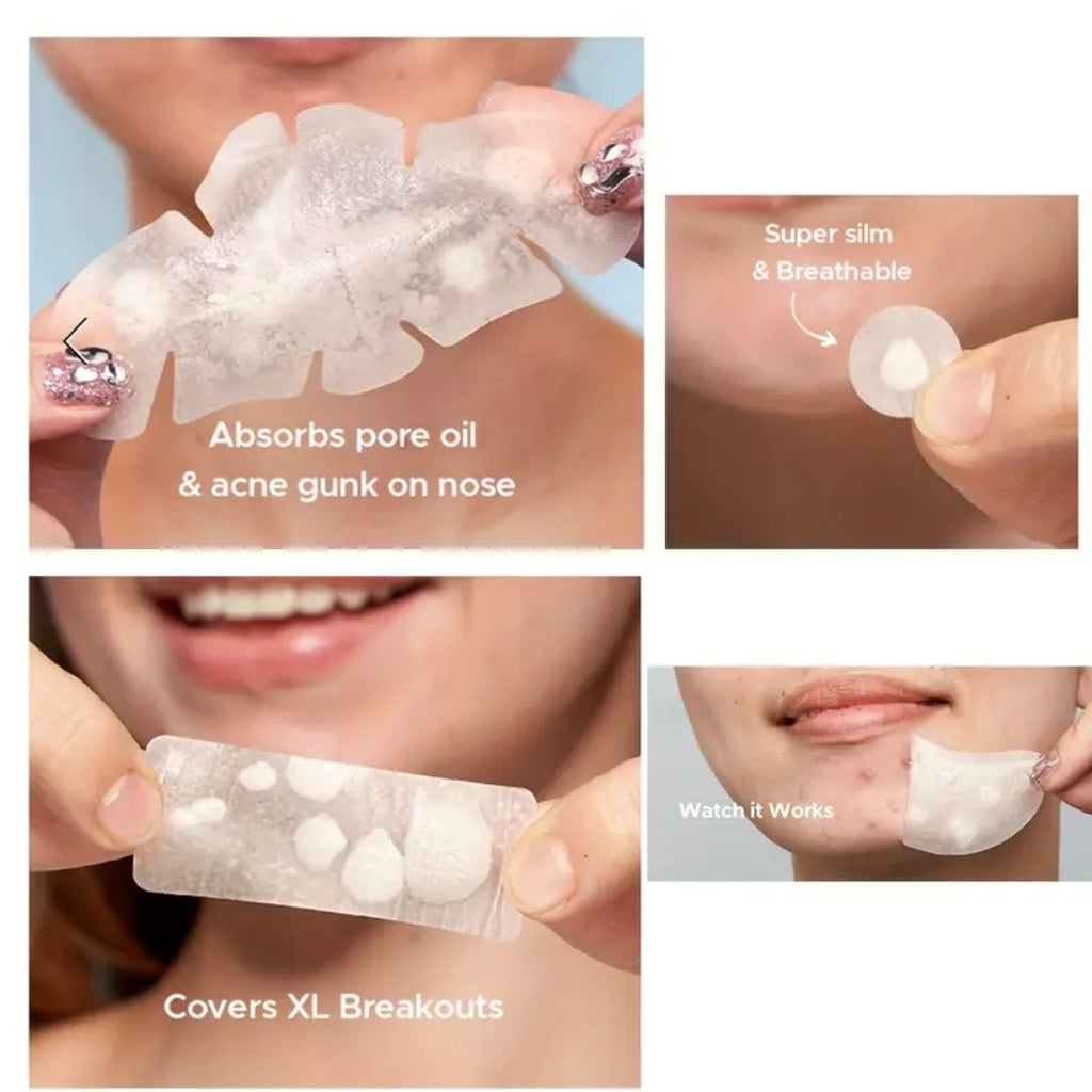 Hydrocolloid Acne Pimple Patches
